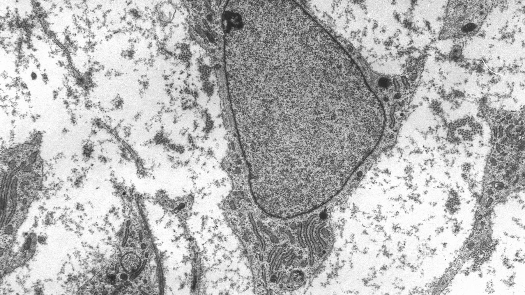 Human mesenchymal stromal cells under magnification